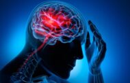 جلطة المخ .. 5 أعراض تشير إلى الإصابة بها